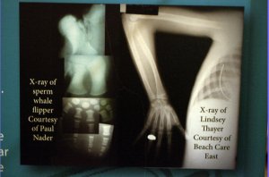 X-ray
